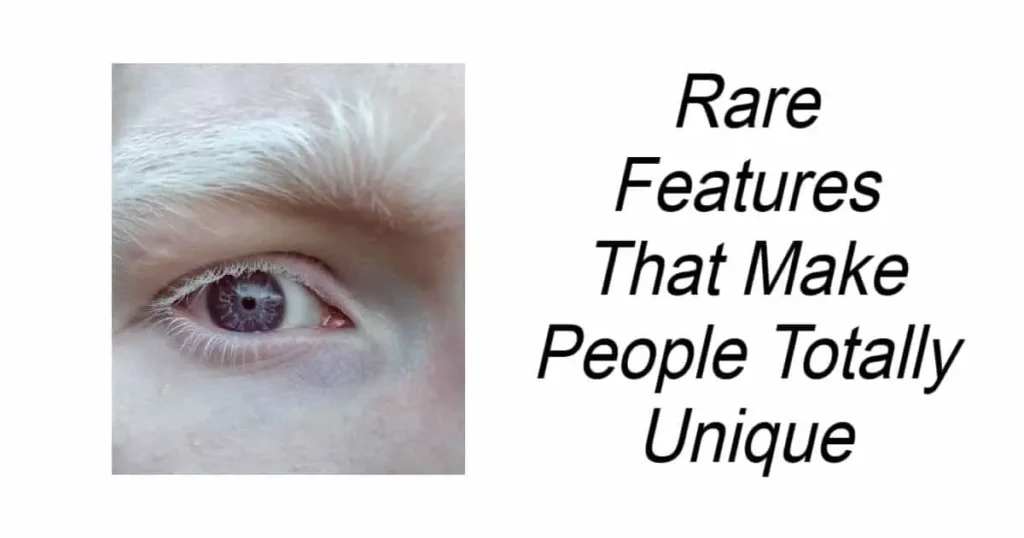 Rare Features That Make People Totally Unique