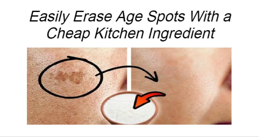 Easily Erase Age Spots With a Cheap Kitchen Ingredient