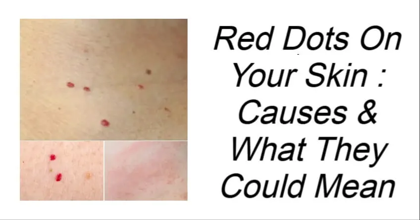 Red Dots On Your Skin