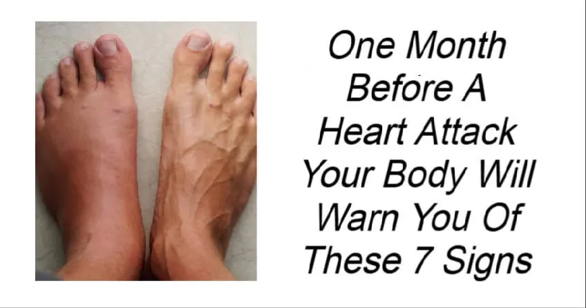 Before A Heart Attack Your Body Will Warn You