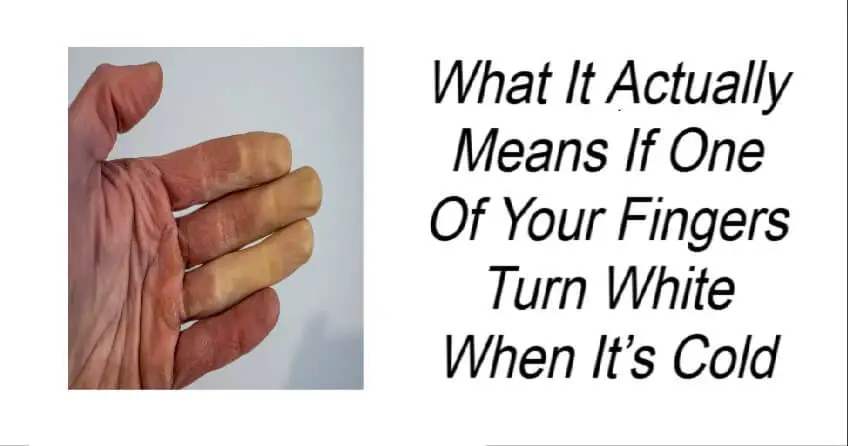 What It Means If Your Fingers Turn White When It’s Cold