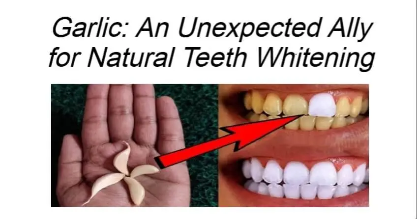 Garlic: An Unexpected Ally for Natural Teeth Whitening