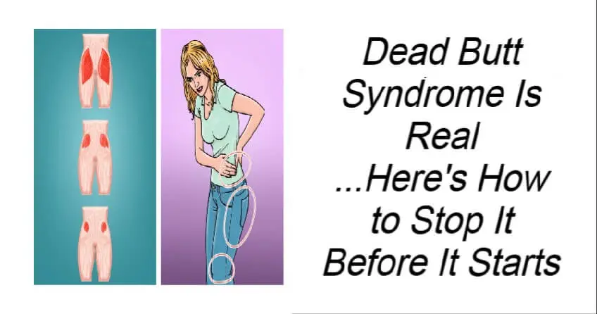 Dead Butt Syndrome Is Real