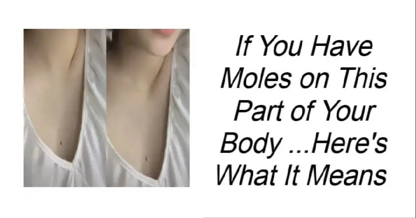 If You Have Moles on This Part of Your Body